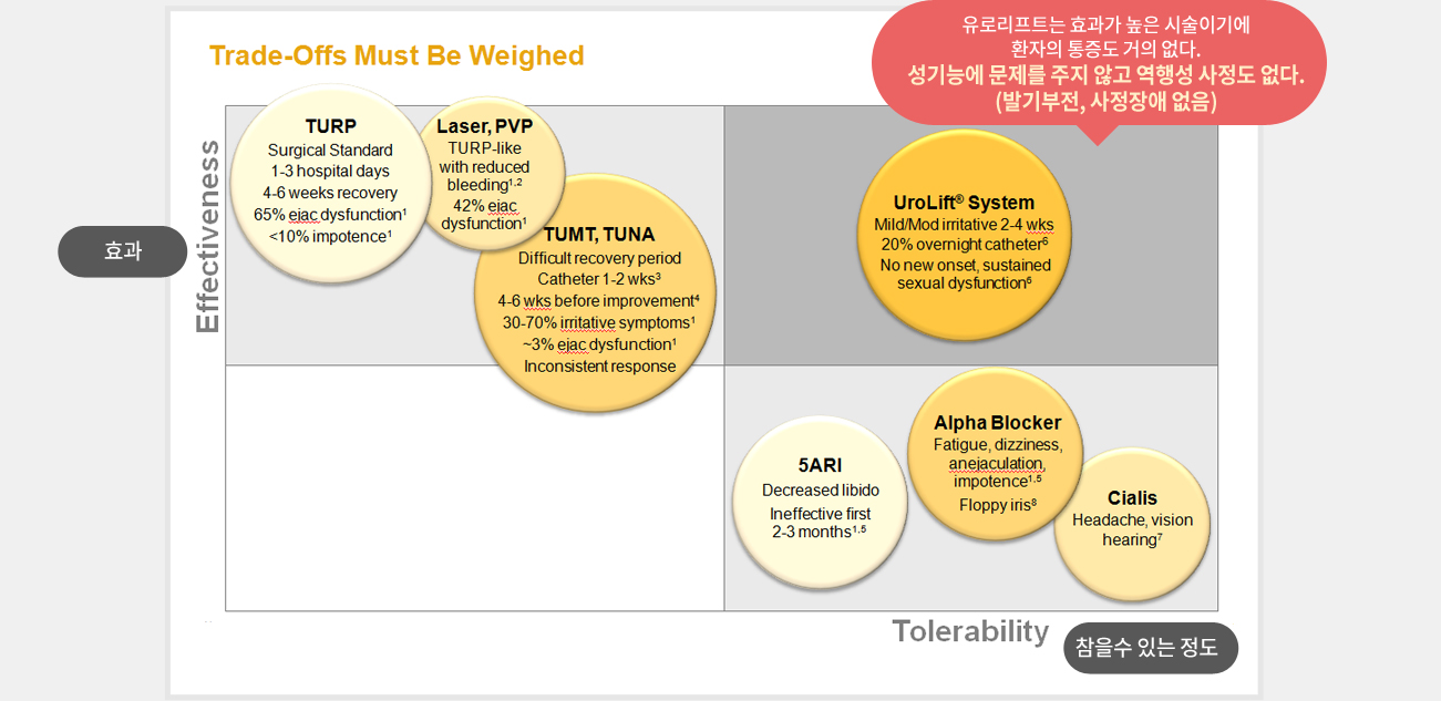유로리프트는 효과가 높은 시술이기에 환자의 통증도 거의 없다. 성기능에 문제를 주지 않고 역행성 사정도 없다. (발기부전, 사정장애 없음)