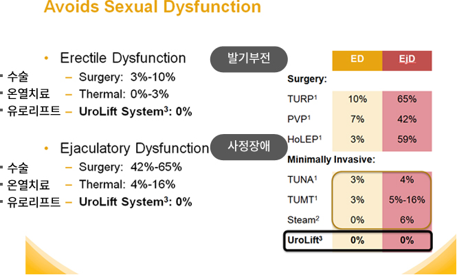 유로리프트는 발기부전이나 사정장애가 생길확률이 0%